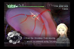 Related Images: Trauma Center on Wii Slips to Spring News image